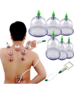 Buy Massage cups for joints 'PULL OUT A VACUUM APPARATUS', 6pcs  | Online Pharmacy | https://pharm-pills.com